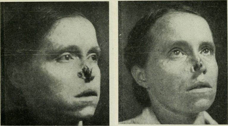 Industries of exploitation: The ‘Radium Girls’ and the state of industrial working conditions today