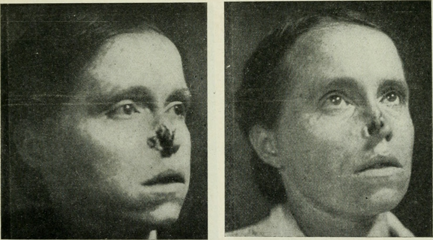 Industries of exploitation: The ‘Radium Girls’ and the state of industrial working conditions today